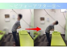 ケアるら整骨院 富里院/ビフォーアフター