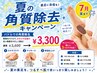 【7月限定★】足元の角質除去キャンペーン♪￥3,600→￥3,300