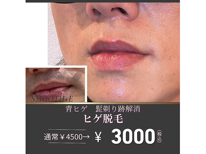 スムース イー(Smooth+E)の写真