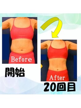 フェリス.ディア(Feliz.Dia)/【ビフォーアフター5】