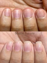 マリーロール 淀屋橋本店(Marie Laure)/自爪育成/深爪矯正/ネイルケア
