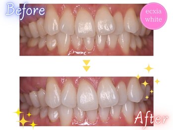 エクシアホワイト 倉吉店(ecxia white)/ビフォーアフター