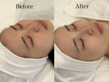 リフコウベ(LIF KOBE)/アンストレスホームケアで美肌♪