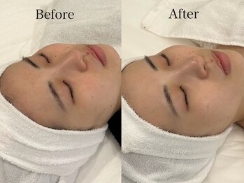 リフコウベ(LIF KOBE)/アンストレスホームケアで美肌♪