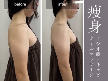 アムールサロン(Amour salon)/痩身/ダイエット/四谷三丁目