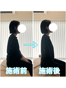 アオ 香椎(AO)/施術前→施術後