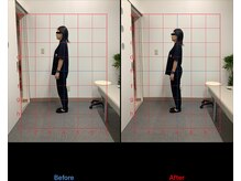 リード整骨院(LEAD整骨院)/姿勢改善、猫背、反り腰