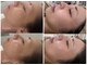 マホロバ(mahoroba)の写真/小顔も美肌も欲張りに。内側と外側から磨く、花嫁のためのブライダル美容