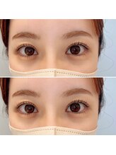 ウルド(URD)/上下まつげパーマ