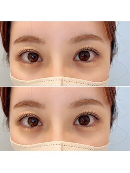 ウルド(URD)/上下まつげパーマ