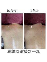 ミルティー(Myrtille)/【お疲れ解消ラジオ波コース】