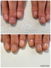 ネイルズシアム/深爪矯正