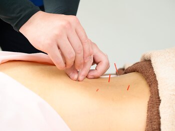 モグサ鍼灸院(MOXA鍼灸院)/お体の状態に合わせた施術