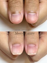 マリーロール 淀屋橋本店(Marie Laure)/自爪育成/深爪矯正/ネイルケア