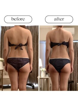 スラン(Slan)/美骨痩身×筋膜リリース90分