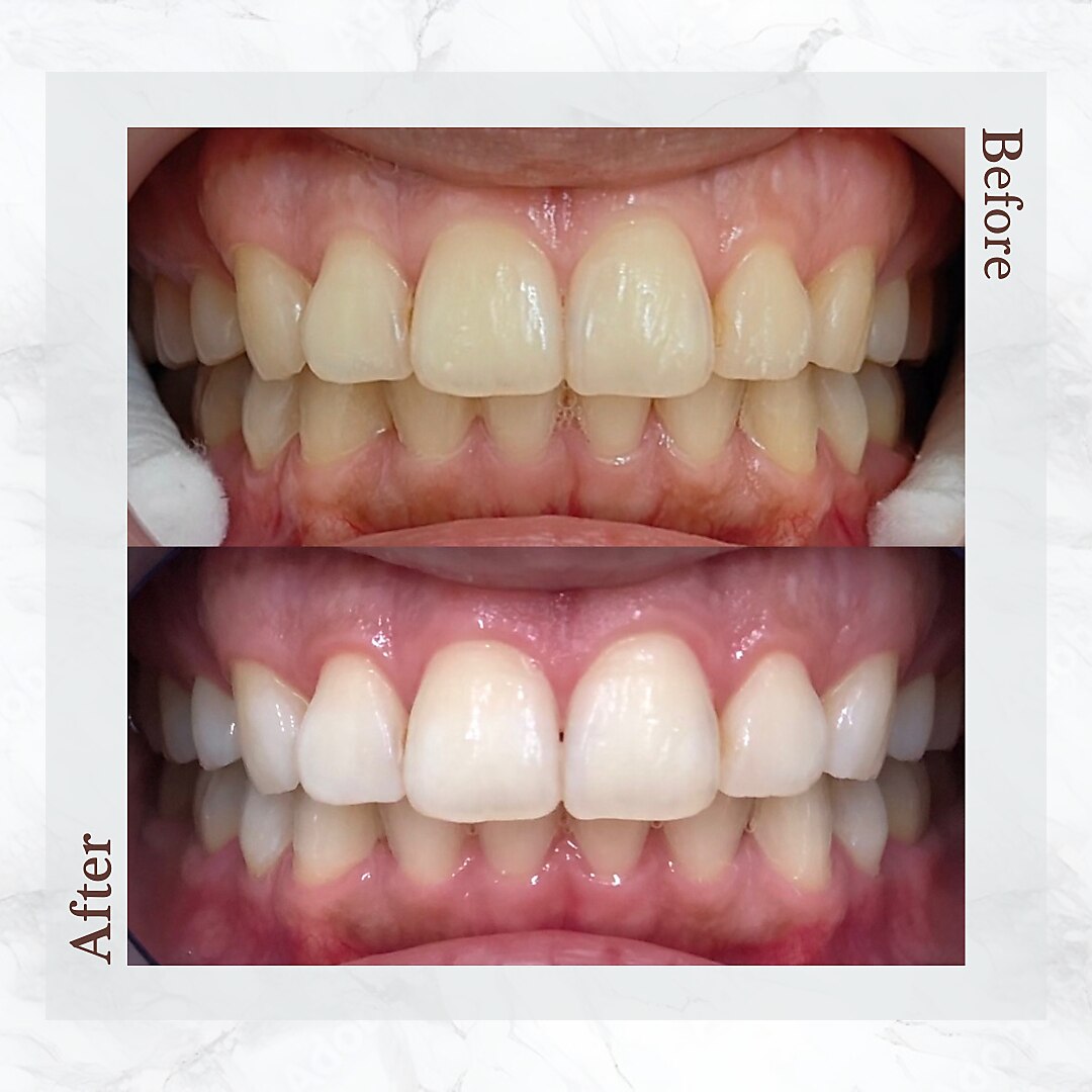 ネックス 津田沼店(NEX)｜ホットペッパービューティー