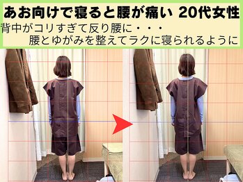 鍼灸 整体院 ひわたし/反り腰で痛かった仰向けもラクに