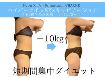 シャルム(charme)/代謝爆上！ハイパーナイフ痩身