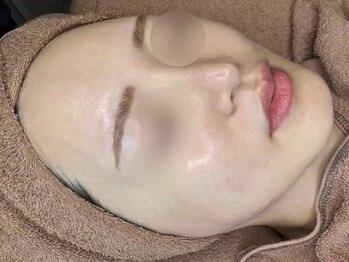 ルブドワール(Le Boudoir)の写真/【今話題沸騰中のララピール☆】お肌のたるみ改善やニキビケアなど…貴方のお肌のお悩み任せてください！