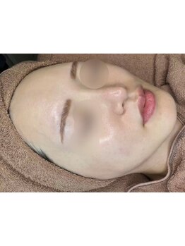 ハリツヤをUPしたい