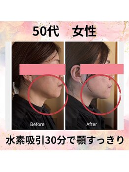 ヨサパーク スイ(YOSA PARK SUI)/