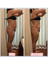 キュール(KuhL)/40代痩身ビフォーアフター☆