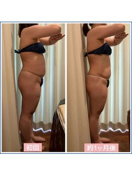 キュール(KuhL)/40代痩身ビフォーアフター☆