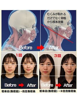 ドクターアーチ 神戸三宮 小顔矯正･整体サロン(Dr.ARCH)/ストレートネックと効果検証