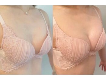 スマイルクルー(SmileClue)/ビフォーアフター症例