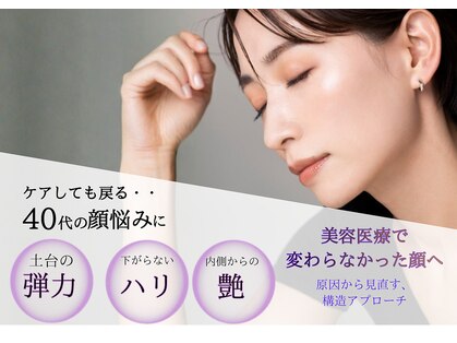 オリノ(Olino)の写真