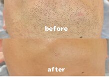 パーミル 千里丘店(per mille‰)