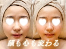 オルテンシア(Hortensia)