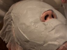 ウォーム(warm)/肌質改善/岡山/フェイシャル