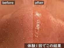 ココモンド(COCOMONDO)の雰囲気（人気NO.1◆ごっそり毛穴洗浄/毛穴/毛穴ケア/毛穴洗浄/上野/湯島）