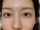アウレル(AUREL)の写真