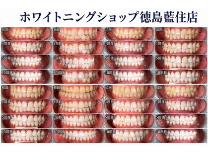 ホワイトニングショップ 徳島藍住店の写真
