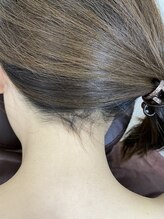 カフー(KAFUU)/【うなじ二回目施術前】