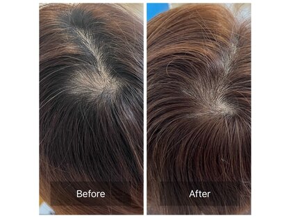 テテ(tete)の写真