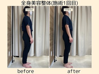 ヴィーネス(VIENESS)/【全身美容整体/肩こり/巻き肩】