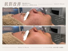 サロンアールミヨン(Salon R Miyon)の雰囲気（お悩みに合わせた本気の肌質改善♪目指せツヤ肌ノーファンデ！）