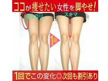 やまもと整骨院の雰囲気(特にココが痩せたい女子からのオーダーが多いため、実績も多数◎)
