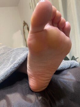 グリーングリーン(GREEN GREEN)/ドイツ式ケアでお悩み解決after