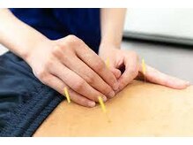 関屋名倉堂鍼灸接骨院/鍼灸施術