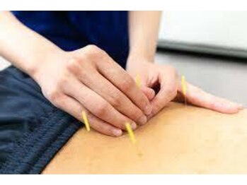 関屋名倉堂鍼灸接骨院/鍼灸施術