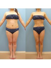 エピア 半田店(Epia)/食べながらダイエット