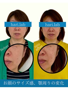 ハリラボ(hari Lab.)/【お客様の声】