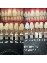 トウキョウスワーズ 池袋店(TOKYO SWRS)/#ホワイトニング #池袋 #渋谷