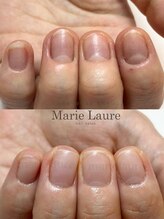 マリーロール 淀屋橋本店(Marie Laure)/自爪育成/深爪矯正/ネイルケア