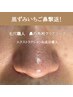 黒ずみいちご鼻撃退！【鼻の角栓クリアコース】エクストラクション付