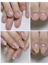 ネイルフレーバー(Nail Fravor)/深爪矯正ナチュラルコース